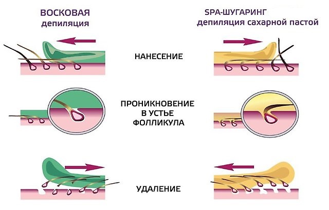 Шугаринг дома: сахарная паста в домашних условиях